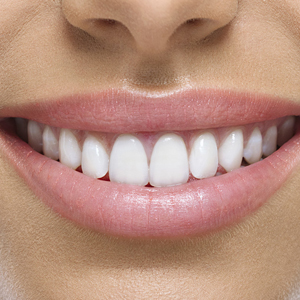 1 Una-sonrisa-perfecta-y-natural_1