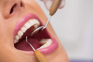 estética dental