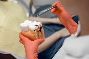 qué es un implante dental