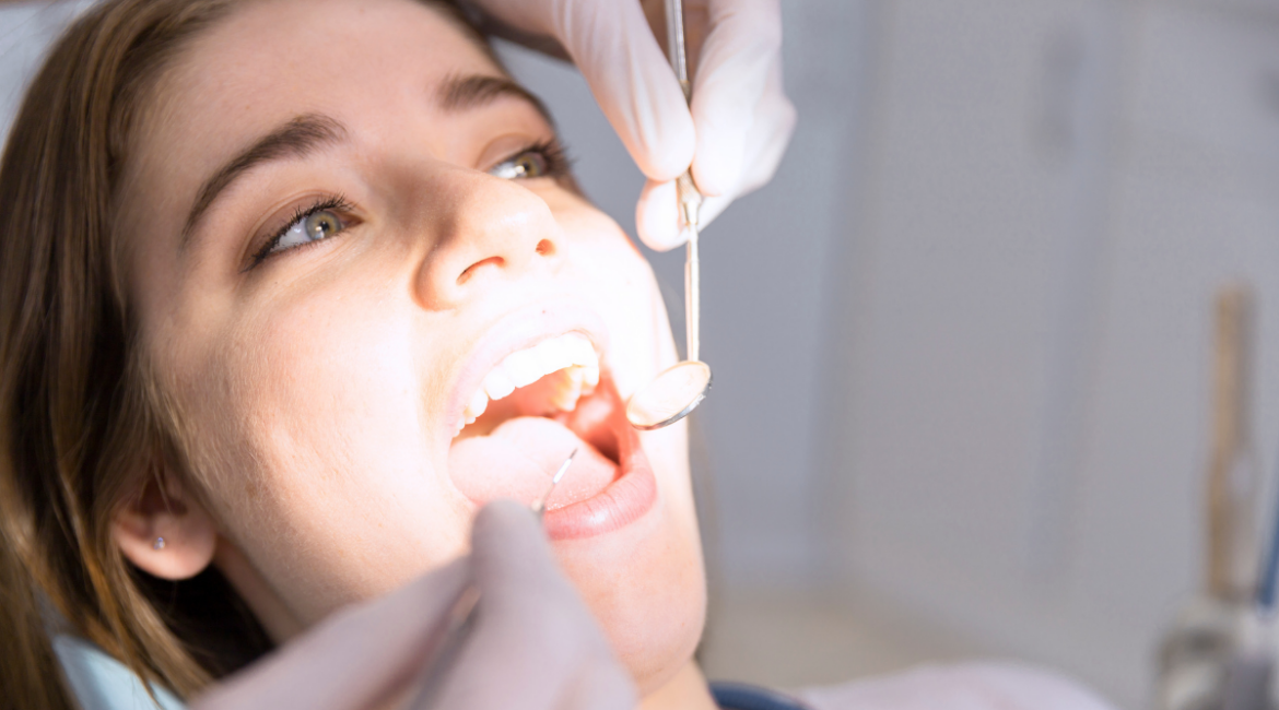 limpieza dental profesional en clínica dental