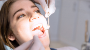 limpieza dental profesional en clínica dental
