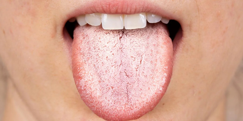 lengua-blanca
