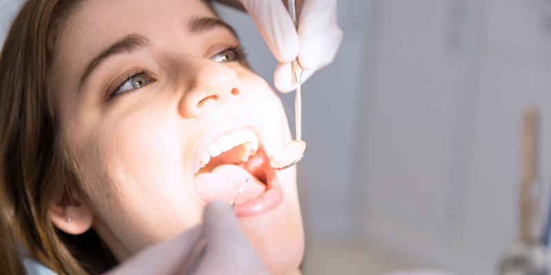 limpieza dental profesional en clínica dental